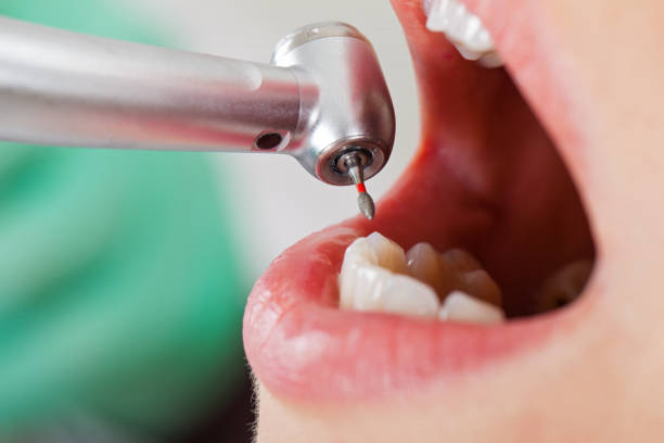 Best Emergency Dental Services Near Me  in Park Layne, OH